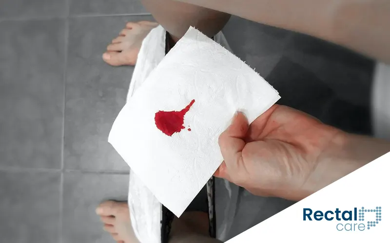 Sangramento anal sem dor: alerta ou condição simples?